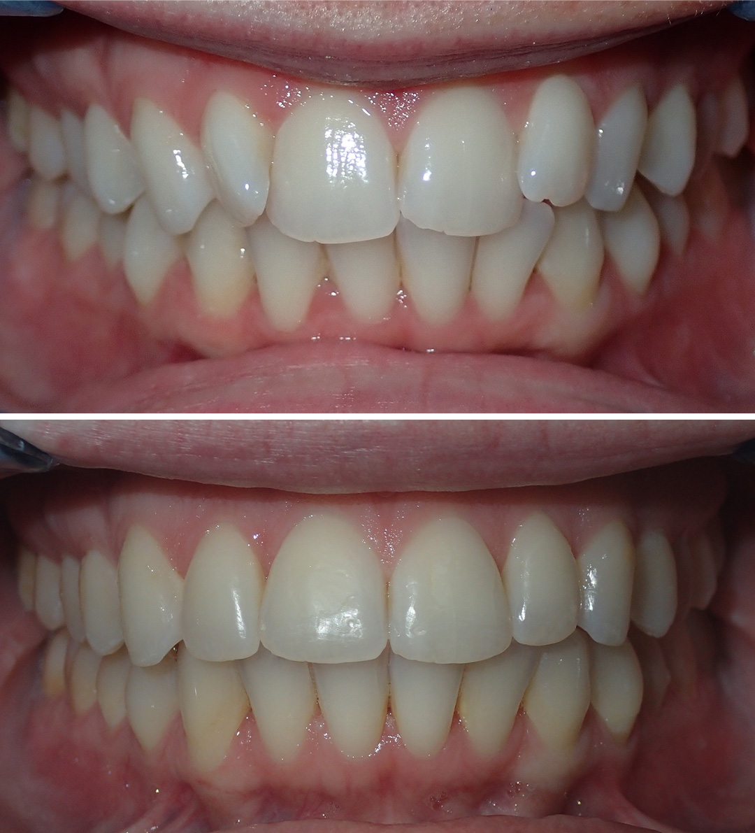 before After image before After image